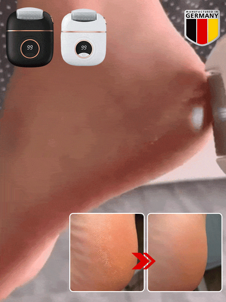 Digital Electric Foot Polisher