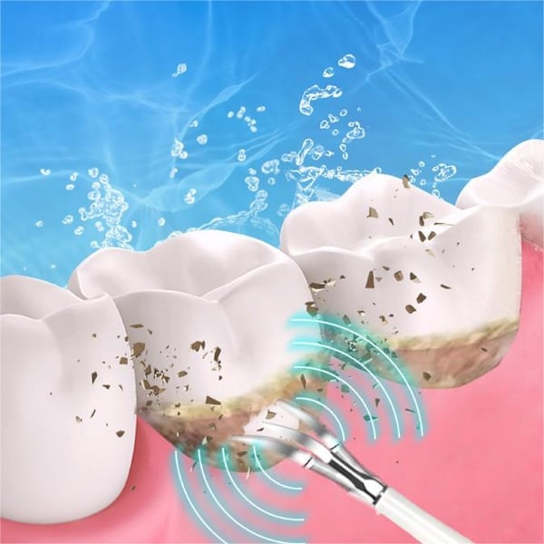 Electric Teeth Cleaner