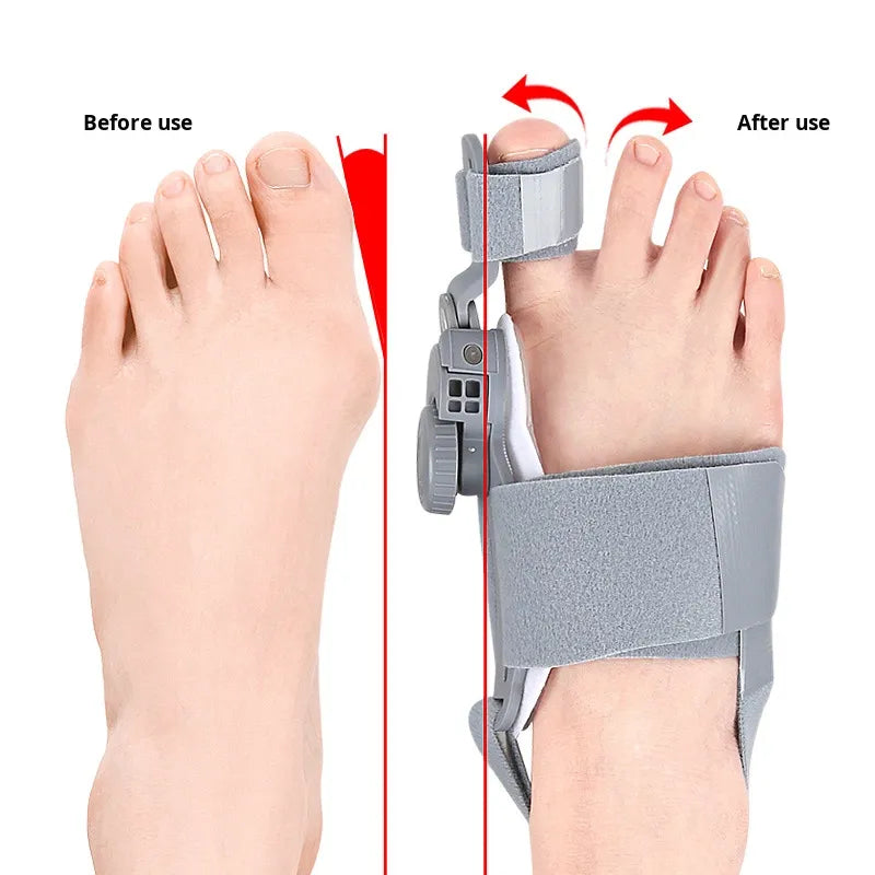Bunion Corrector – Adjustable Big Toe Straightener