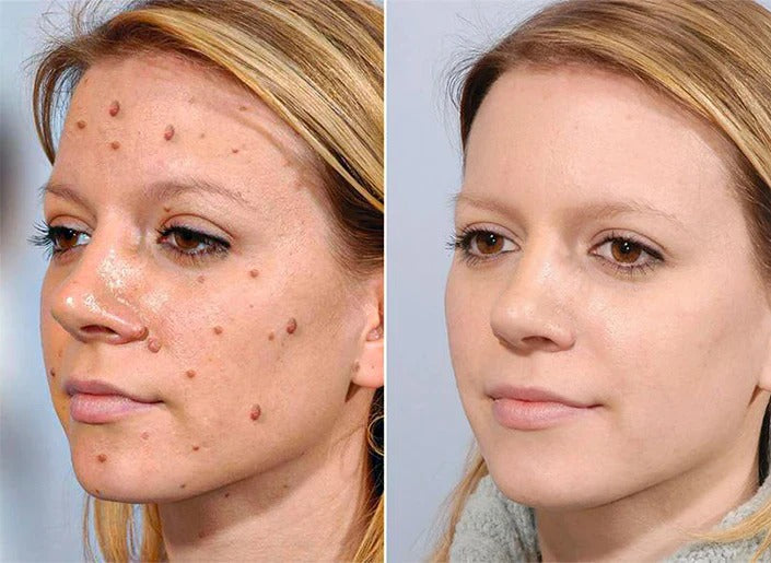 TagRecede Bee Venom Treatment Spray YT