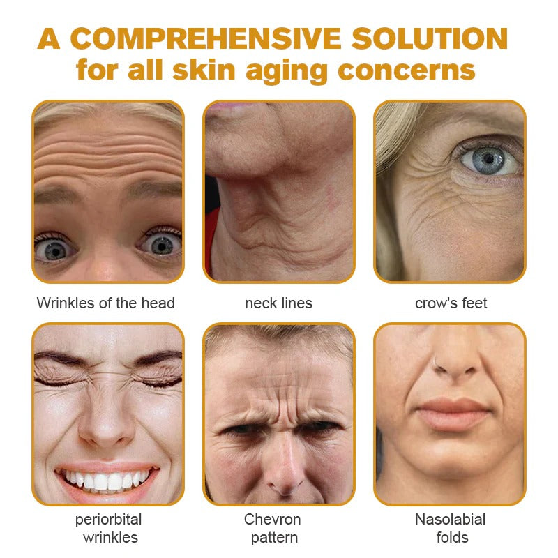 Erase Wrinkles Naturally – for Men & Women TK